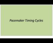 Understanding Pacemakers