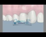 Dental Solutions Algodones