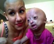 The Progeria Research Foundation