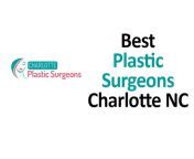 Charlotte Plastic Surgeons
