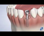 Amarillo Oral u0026 Maxillofacial Surgery and Dental Implants