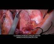 Clayman Thyroid Cancer Center