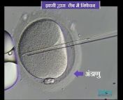 Indore Infertilty Clinic
