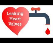 HeartValveSurgery.com
