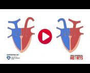 Children&#39;s Heart Surgery Fund (CHSF)