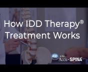 IDDTherapy