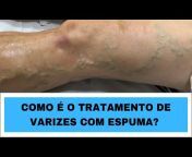 Dra Thayane Guimarães Angiologia e Cir. Vascular