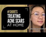 THE ACNE CHANNEL