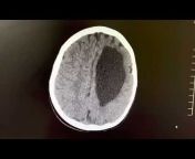 Ultrasound u0026 Radiology Cases