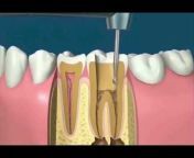 Dental Video