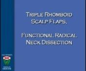 Dr. Stephan Ariyan - TRIPLE RHOMBOID SCALP FLAPS, SLN, FUNCTIONAL RADICAL NECK DISSECTION - 32 minutes, 2008 from ariyan