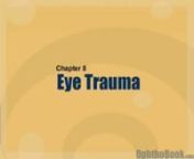In this video lecture from OphthoBook.com, I cover common eye injuries seen by an ophthalmologist.Topics include corneal abrasions, lacerations, hyphema, open globe and hemorrhage.