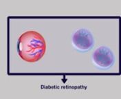 Ataxia telangiectasia mutated (ATM) dysregulation results in diabetic retinopathy from ataxia telangiectasia