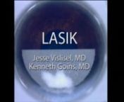 Posted on EyeRounds for Jesse Vislisel, MD and Kenneth M. Goins, MD. This patient underwent laser-assisted in-situ keratomileusis (LASIK) for myopia.A femtosecond laser was used to create the flap.Punctal plugs were placed at the time of surgery due to history of dry eye syndrome.