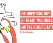 This video gives on overview of the key concepts of mitral regurgitation. The following aspects of the heart murmur are discussed: the 3 main causes, the auscultation site and the heart sounds heard. It is aimed at students completing 1st year Cardiology block. It is intended to be used in conjunction with lectures and practical sessions given during this block rather than exclusively. nn© University of Dundee School of Medicine 2016 n nScripted, storyboarded, voiceover and video edited by Sam