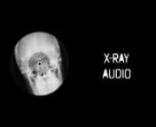 More: http://dzierza.com/2015/02/x-ray-audio-illegal-music-on-the-bone/nnWhen Soviet Russia banned Western (and certain domestic) artists in the 1940s and 50s, many bootleggers started producing illegal records using old hospital x-ray films using a technology that originated from Hungary.nnX-Ray Audio is a project dedicated to preserving these recordings and documenting the efforts of the bootleggers. For more info go to http://www.x-rayaudio.squarespace.com . nnFilmed and produced by Michal Dz