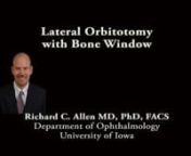 This is Richard Allen at the University of Iowa.This video demonstrates a lateral orbitotomy with removal of the lateral orbital rim.This patient has a history of orbital inflammation, s/p previous orbit decompression, but has continued exposure keratopathy and elevated intraocular pressure secondary to his proptosis.A lateral canthotomy is performed followed by inferior and superior cantholysis.4-0 silk sutures are placed for traction through the lateral tarsus of the upper and lower li