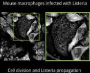 This video shows label-free live cell imaging of mouse macrophages infected with Listeria imaged with the 3D Cell Explorer - a label-free live cell imaging microscope. nnIn this video we observe mouse macrophages that have been infected with Listeria monocytogenes.nnAt the beginning of the video, the cell at the top of the field of view is going through mitosis.The chromosomes&#39; condensation is clearly observable in the center of the cell. Listeria bacteria are observable in this same host cell