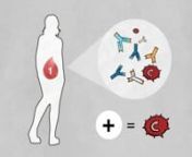 Watch this short 2 minute animated video to learn about the different tests for Hepatitis C and the meaning of the different test results.