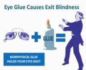 http://www.lucidology.comnnA lot of times when you enter an O.B.E you&#39;ll find that you can&#39;t see. This is called exit blindness. Here in part 9 we&#39;ll cover the 3 simplest and quickest solutions to exit blindness to recover your sight as fast as possible.nn n