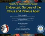 Reaching the Impossibl Endoscopic Surgery of Clivus and Petrous Apex.mp4 from impossibl