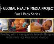 Feeding with a Nasogastric Tube (Bangla) - Small Baby Series from bangla baby