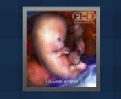Whether you are pregnant or just interested in pregnancy-related topics, we hope you enjoy this brief overview of some of the prenatal education resources brought to you by EHD. You can find out more at http://www.ehd.org/see-baby.php. Best viewed in full-screen mode!