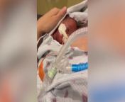 A family has shared the beautiful moment their daughter, who was born nearly four months early, was finally able to leave the NICU after a 247-day stay. River was due to be born on September 7, 2023, but on May 7 of that year, her mom Shelby Rutledge’s water broke unexpectedly at only 22 weeks and four days pregnant. At the time, doctors told Shelby that they were in a gray area – which later resulted in River being given the middle name Grae – as there was a chance she would not survive if she were born so early. After 16 days in hospital, Shelby gave birth to River, who at the time weighed just one pound and six ounces. Though River was born at 24 weeks, her lungs were only at the level of a 22-week-old&#39;s, as that was when her water broke. As a result, the family was told that they may need to expect River to remain in the NICU for up to a year, with Shelby documenting her daughter&#39;s progress on her social media account. After more than seven months in Oklahoma Children’s Hospital&#39;s NICU, the family was finally told that River was well enough to go home. On January 25, 2024, they made their way out of the NICU, where Shelby&#39;s mom recorded the staff&#39;s uplifting reaction as River made her way out of the hospital.