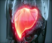 10 Signs of a Dying Liver(End Stage Liver Disease) from p stage uppa