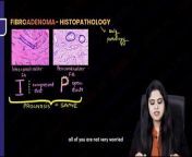 Breast tumors classification \ \breast pathologyL-1 from classification in hindi