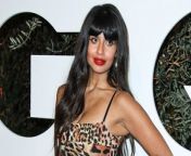 Jameela Jamil has taken to social media to reveal that she recently underwent &#92;