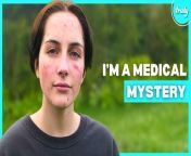 MEDICAL MYSTERY, Beth, experiences extreme allergic reactions to &#92;