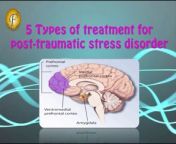 #stress #meditation #stresstreatment&#60;br/&#62;A condition of persistent mental and emotional stress occurring as a result of injury or severe psychological shock, typically involving disturbance of sleep and constant vivid recall of the experience, with dulled responses to others and to the outside world. So, here we have 5 types to treatment for you which will give you relief in Post Traumatic Stress disorder.&#60;br/&#62;&#60;br/&#62;You can also view our other informative videos based on coupling problems &amp; human internal body problems, causes, symptoms &amp; with their solutions.
