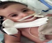 Doctors were ready to flick Marwa&#39;s life support machine off, until she opened her eyes to prove she was still alive. &#60;br/&#62; &#60;br/&#62; &#60;br/&#62;