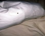 Mum horrified after finding bed bugs in Blackpool guest house from xxlnew milon bed 2015